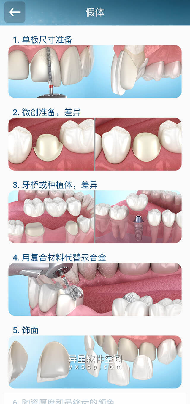 Dental Illustrations「牙科3D插图供患者咨询」v2.0.94 for Android 解锁订阅版 +  内置数据包 —— 为想要更有效地建议患者的专业牙医而设计-颌骨, 解剖, 牙科插图, 牙科3D插图, 牙科, Dental Illustrations, 3D插图